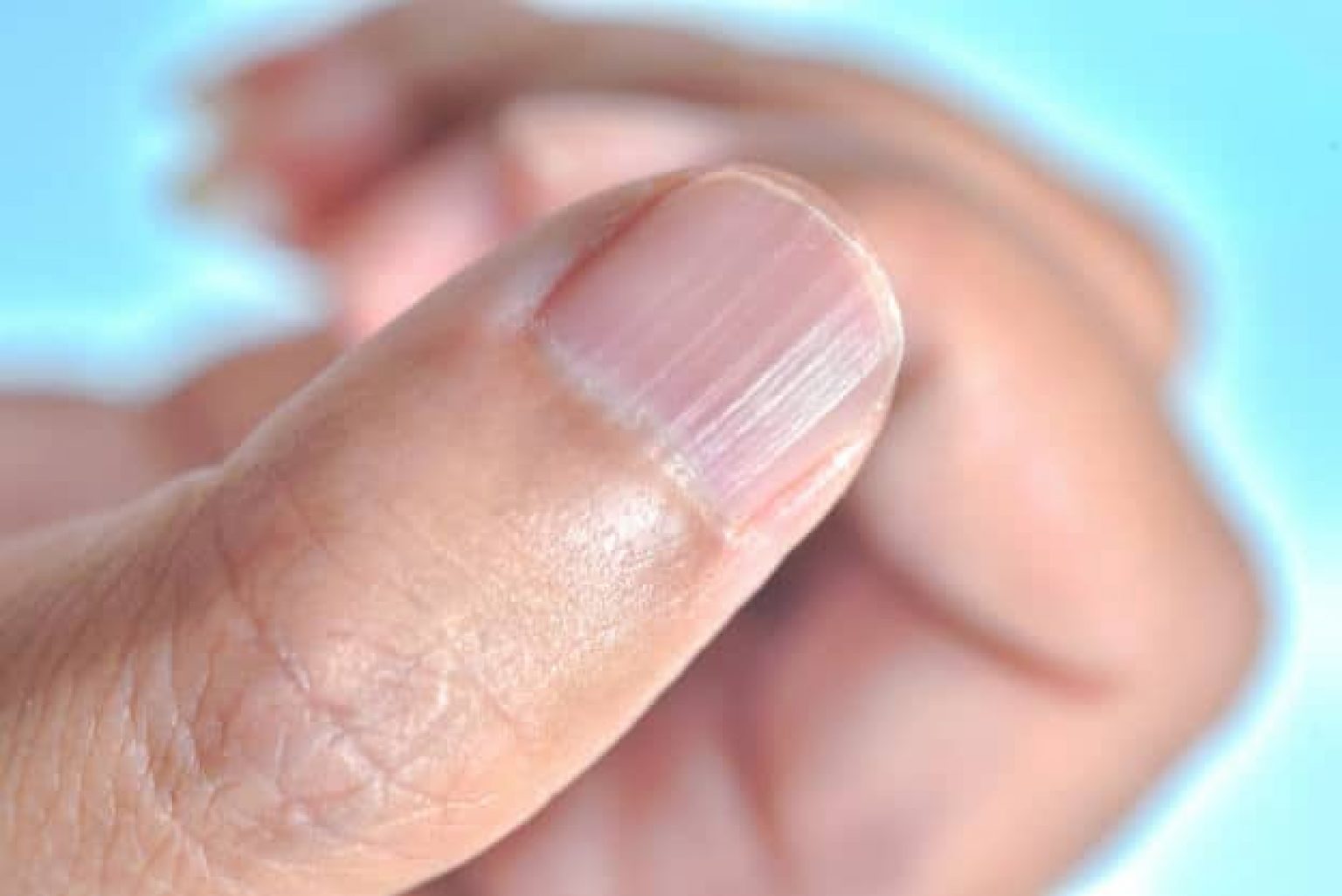 what-those-vertical-lines-on-your-nails-mean-about-your-health